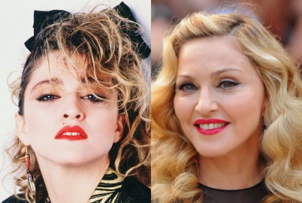 Madonna-Before-And-After-Plastic-Surgery