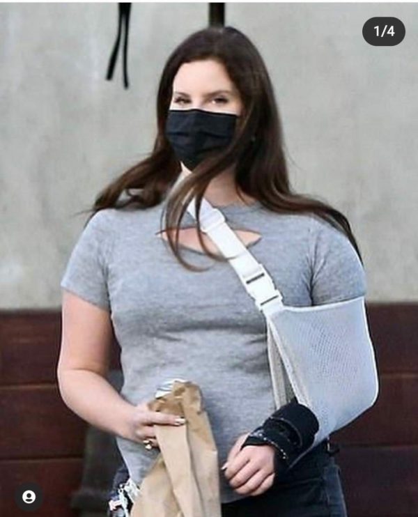 Lana Del Rey Si É Rotta Un Braccio, Ed É Ingrassata Ancora 5 Fb Img 1609112224294