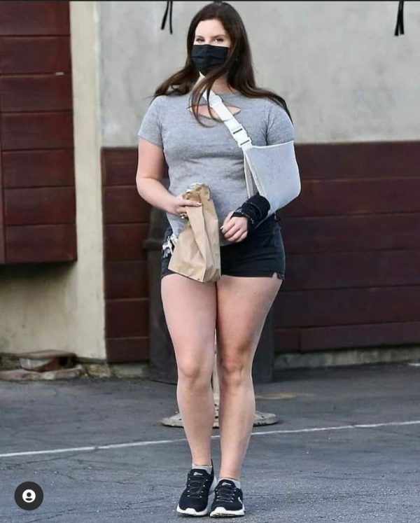 Lana Del Rey Si É Rotta Un Braccio, Ed É Ingrassata Ancora 2 Fb Img 1609112229124