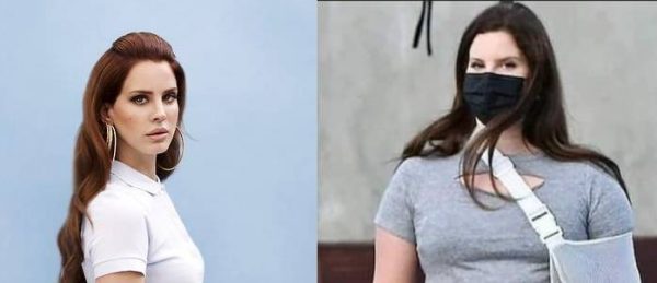 Lana Del Rey Si É Rotta Un Braccio, Ed É Ingrassata Ancora 1 Lana Del Rey Ingrassa Ancora