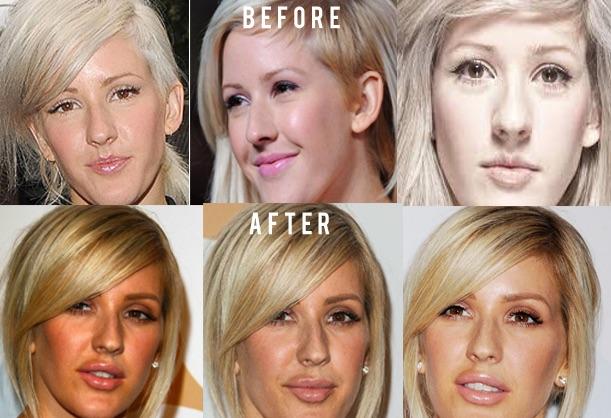 Cosa É Successo Ad Ellie Goulding? Vittima Della Chirurgia Estetica. 1 Ellie Goulding Chirurgia2